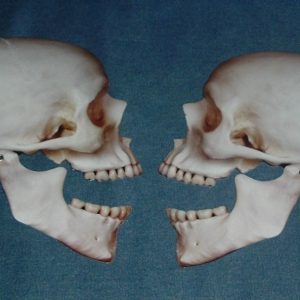 PAIR OF POSEABLE JOINTED SKULLS - LARGE