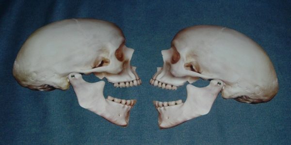 PAIR OF POSEABLE JOINTED SKULLS - LARGE